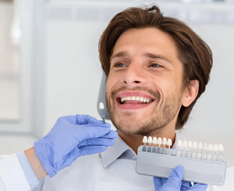 Minimal Prep Veneers in Highlands Ranch, CO - Chiu Aesthetics