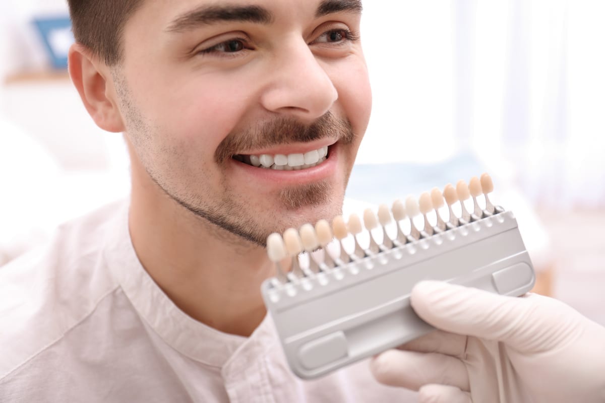Veneers in Carriage Club